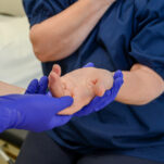 A nurse examines a patient's hand