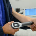A TENS machine being used on a patient's elbow