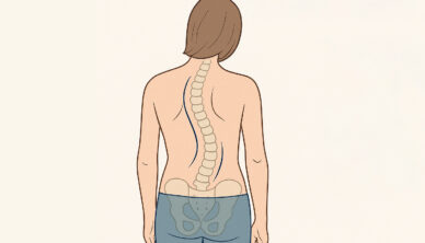 Scoliosis illustration